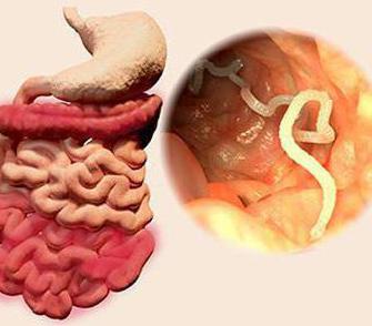 Hvite ormer i avføring. Pinworms hos barn: symptomer og behandling