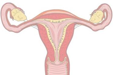 Hvordan stoppe blødning med menstruasjon hjemme?