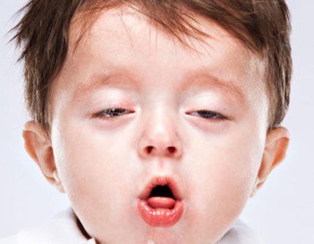 Tørr hoste hos barn uten feber: årsaker og behandling